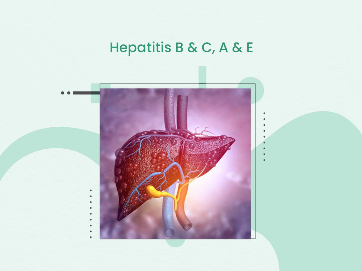 Hepatitis